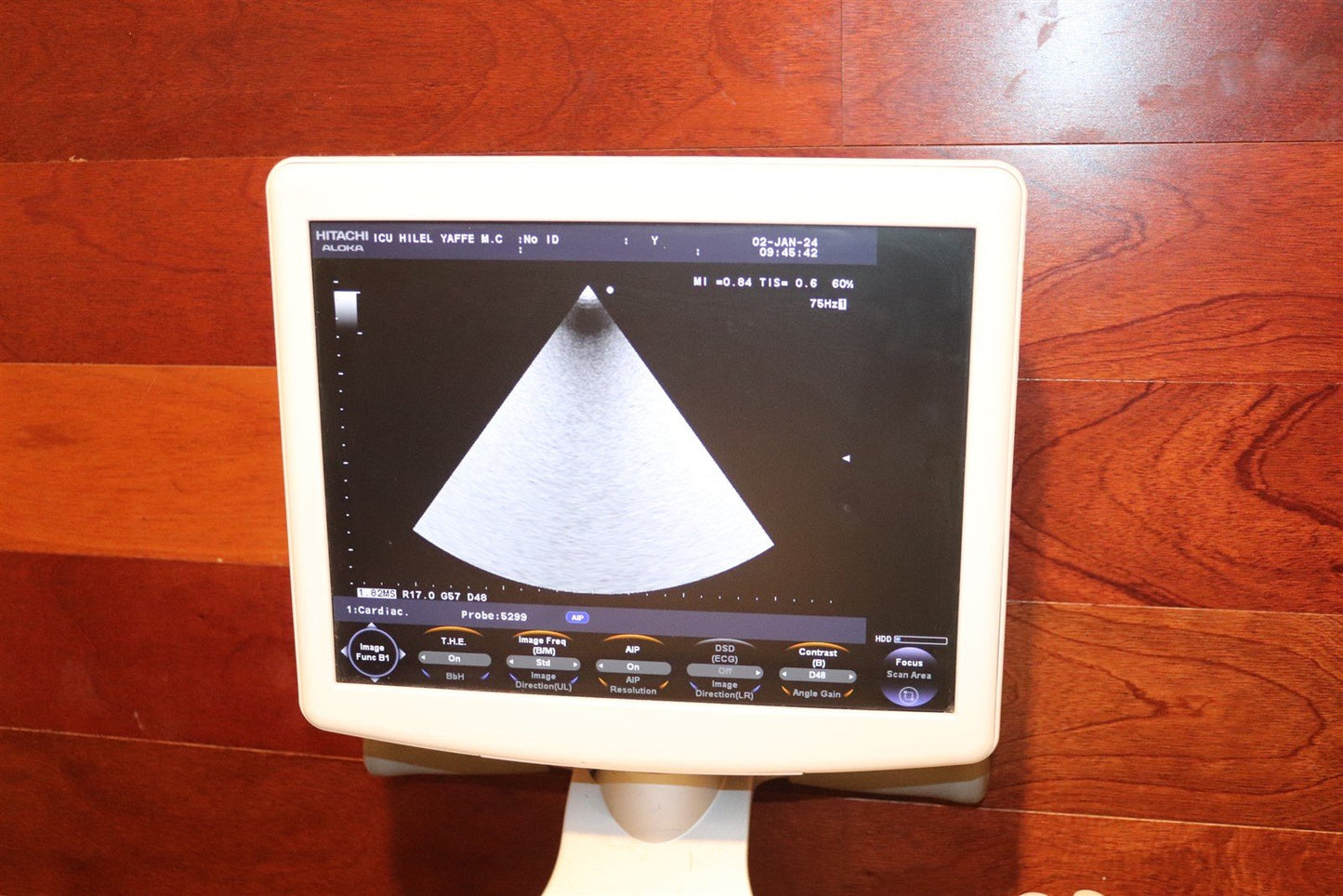 Hitachi Aloka Ultrasound F31 3 Probes Included