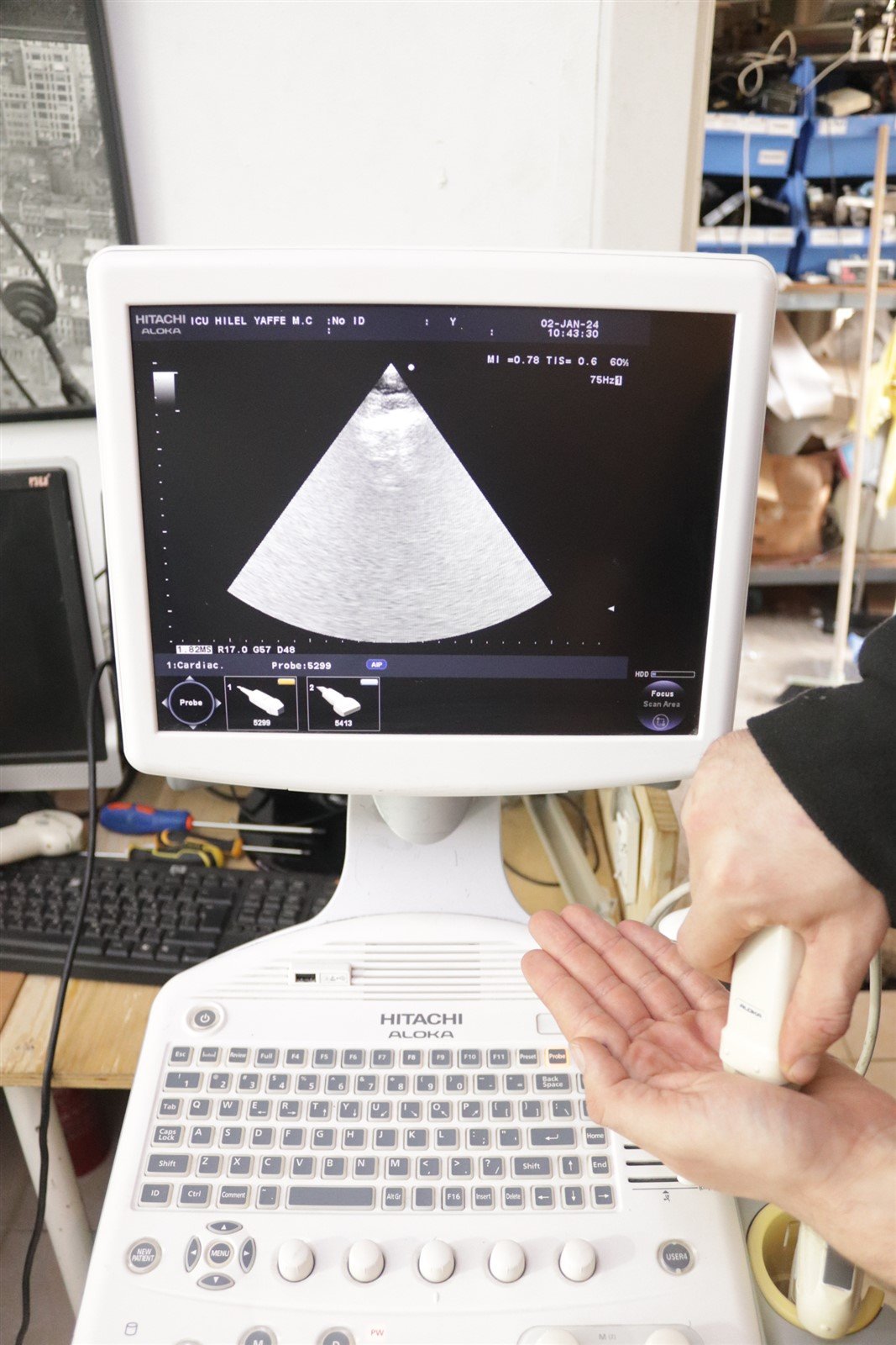 Hitachi Aloka Ultrasound F31 3 Probes Included