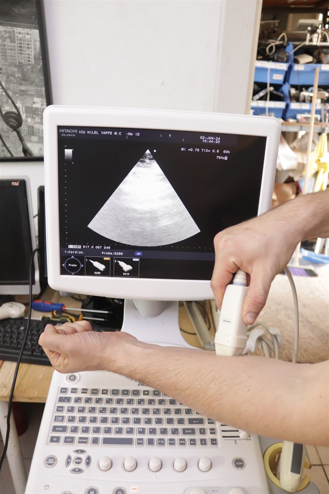 Hitachi Aloka Ultrasound F31 3 Probes Included