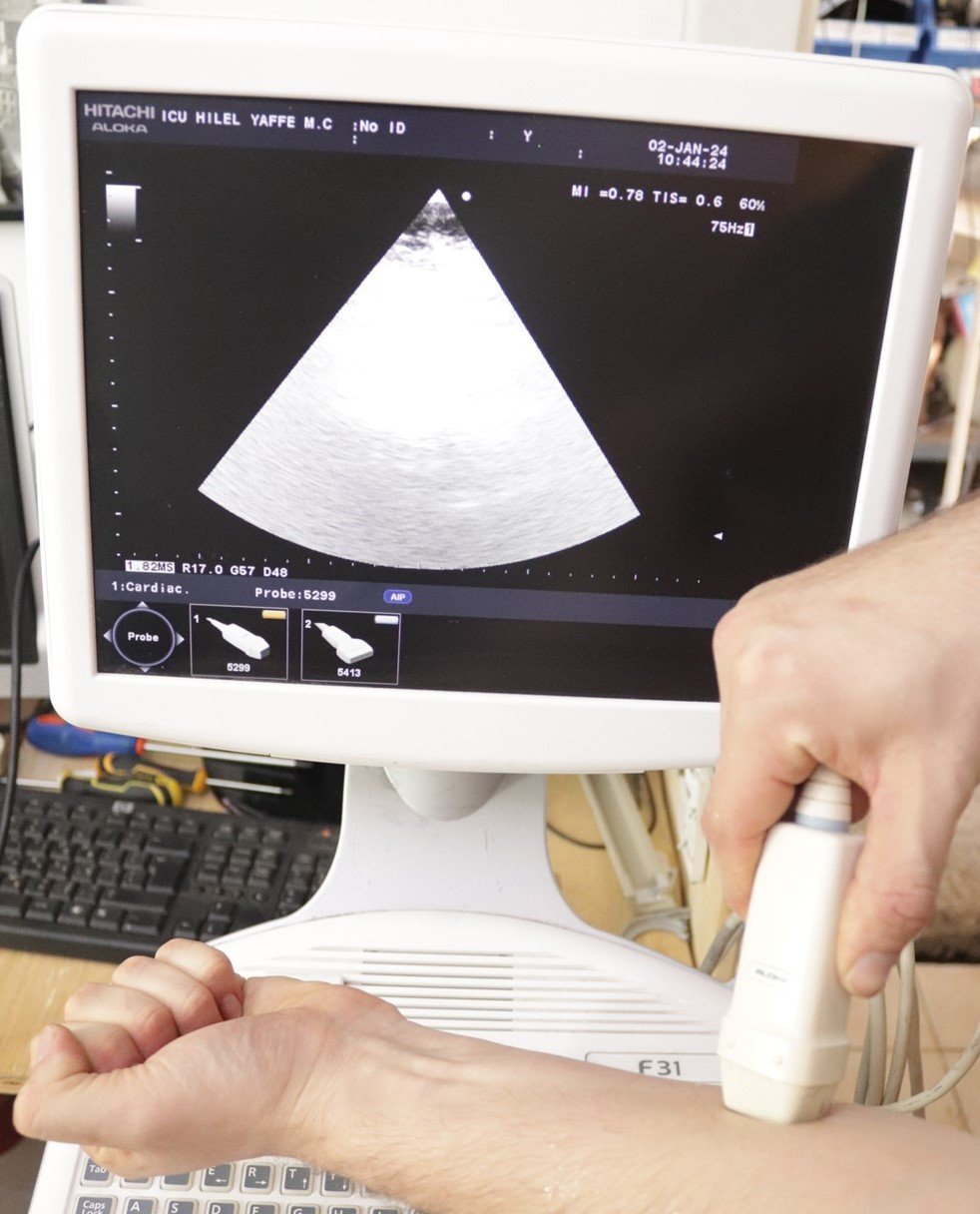 Hitachi Aloka Ultrasound F31 3 Probes Included