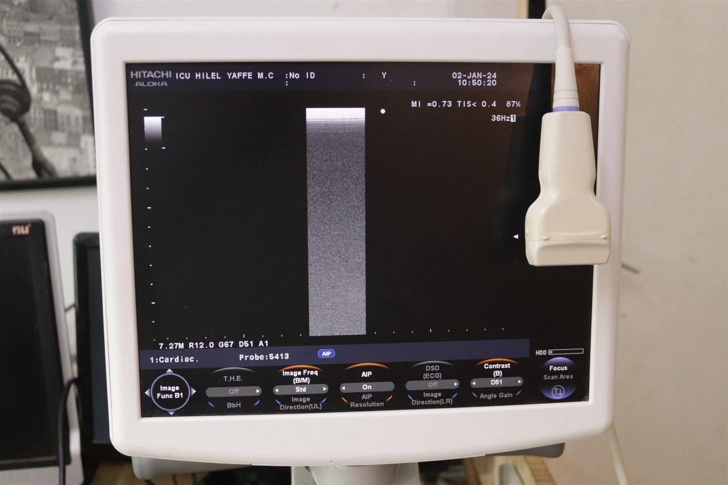 Hitachi Aloka Ultrasound F31 3 Probes Included