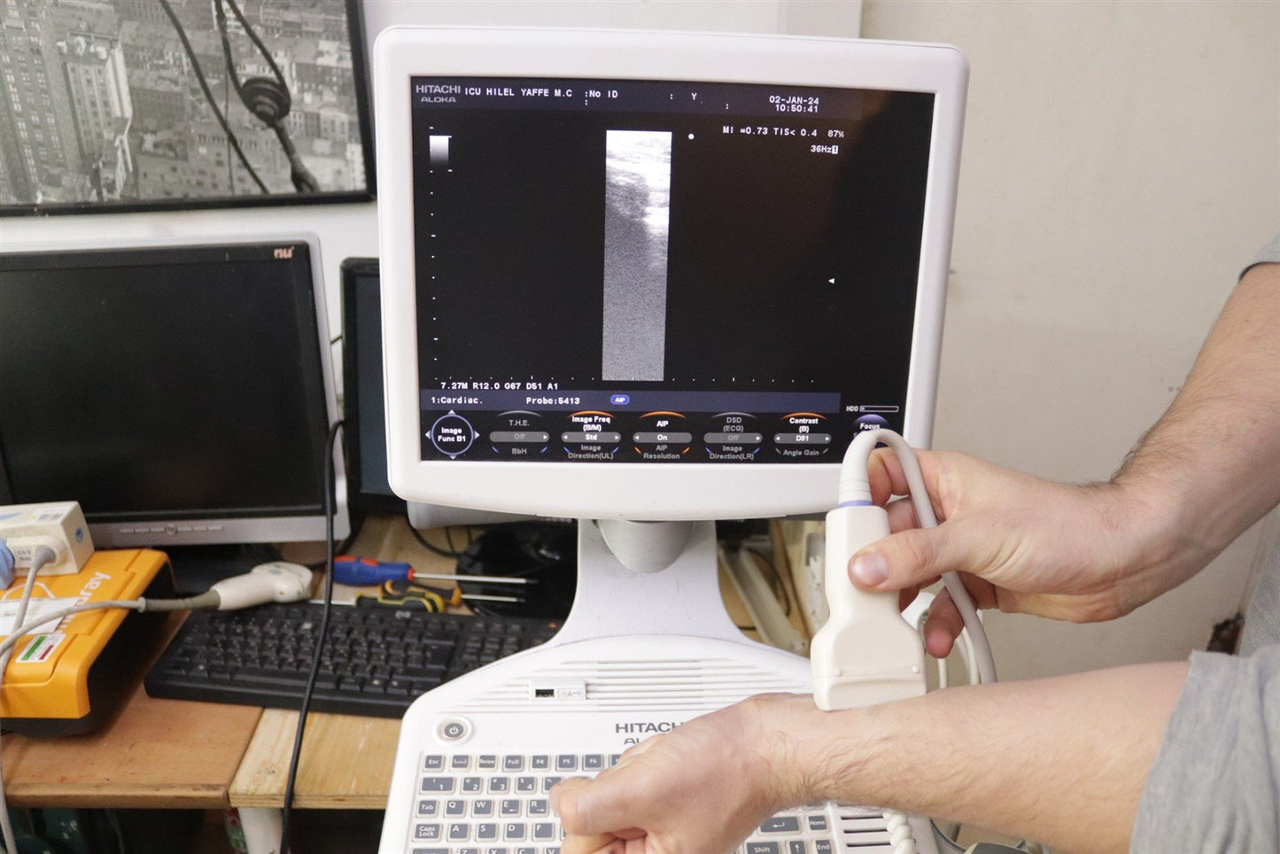 Hitachi Aloka Ultrasound F31 3 Probes Included