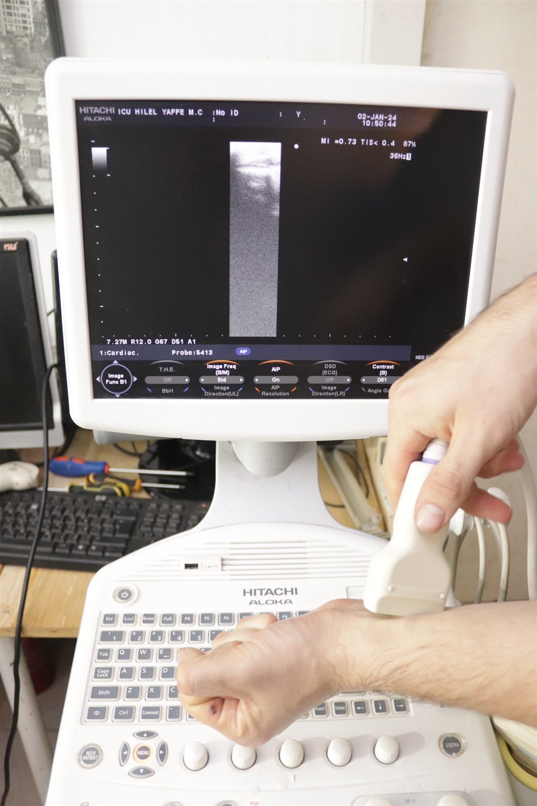 Hitachi Aloka Ultrasound F31 3 Probes Included