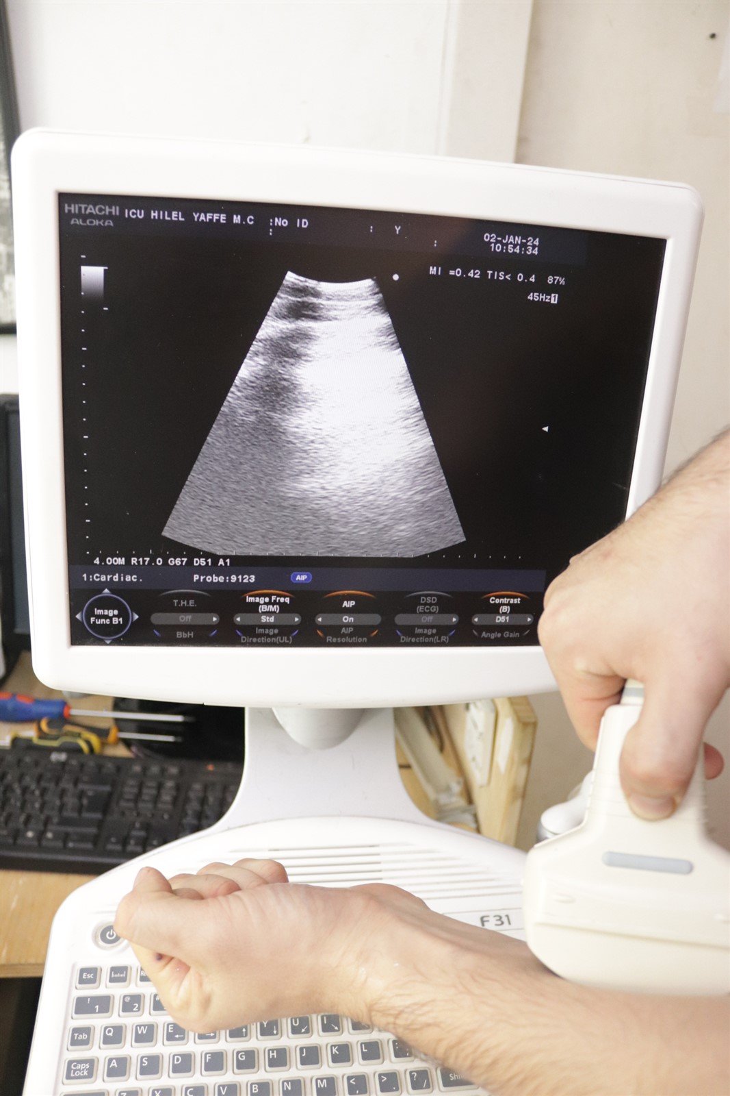 Hitachi Aloka Ultrasound F31 3 Probes Included