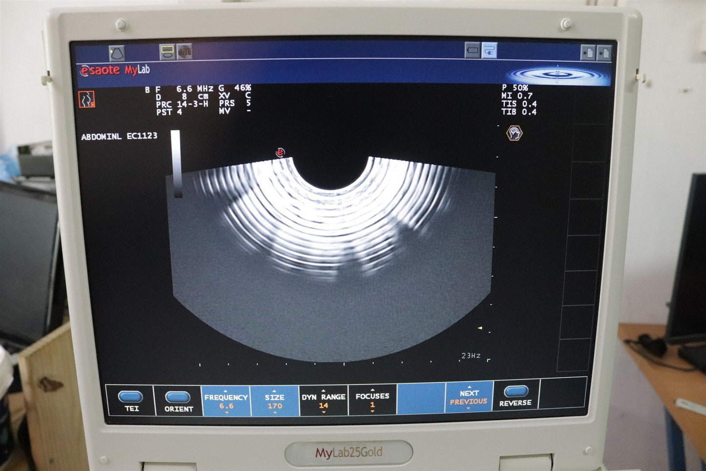 TESTED Esaote MyLab25 Gold 7340 Ultrasound With 2 Probes