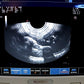 TESTED Esaote MyLab25 Gold 7340 Ultrasound With 2 Probes