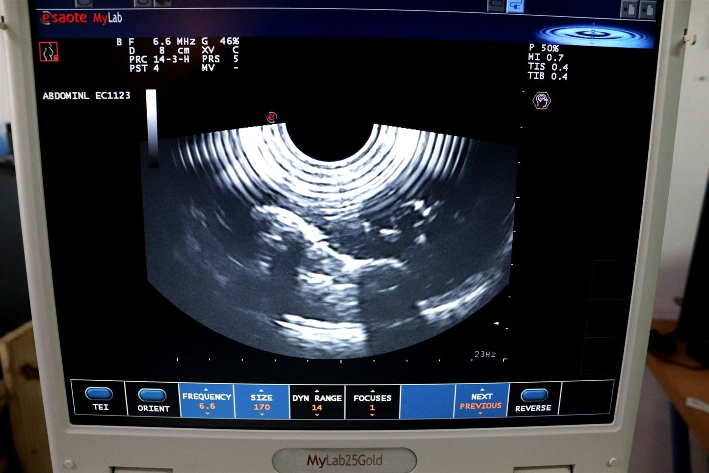 TESTED Esaote MyLab25 Gold 7340 Ultrasound With 2 Probes