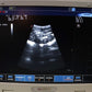 TESTED Esaote MyLab25 Gold 7340 Ultrasound With 2 Probes
