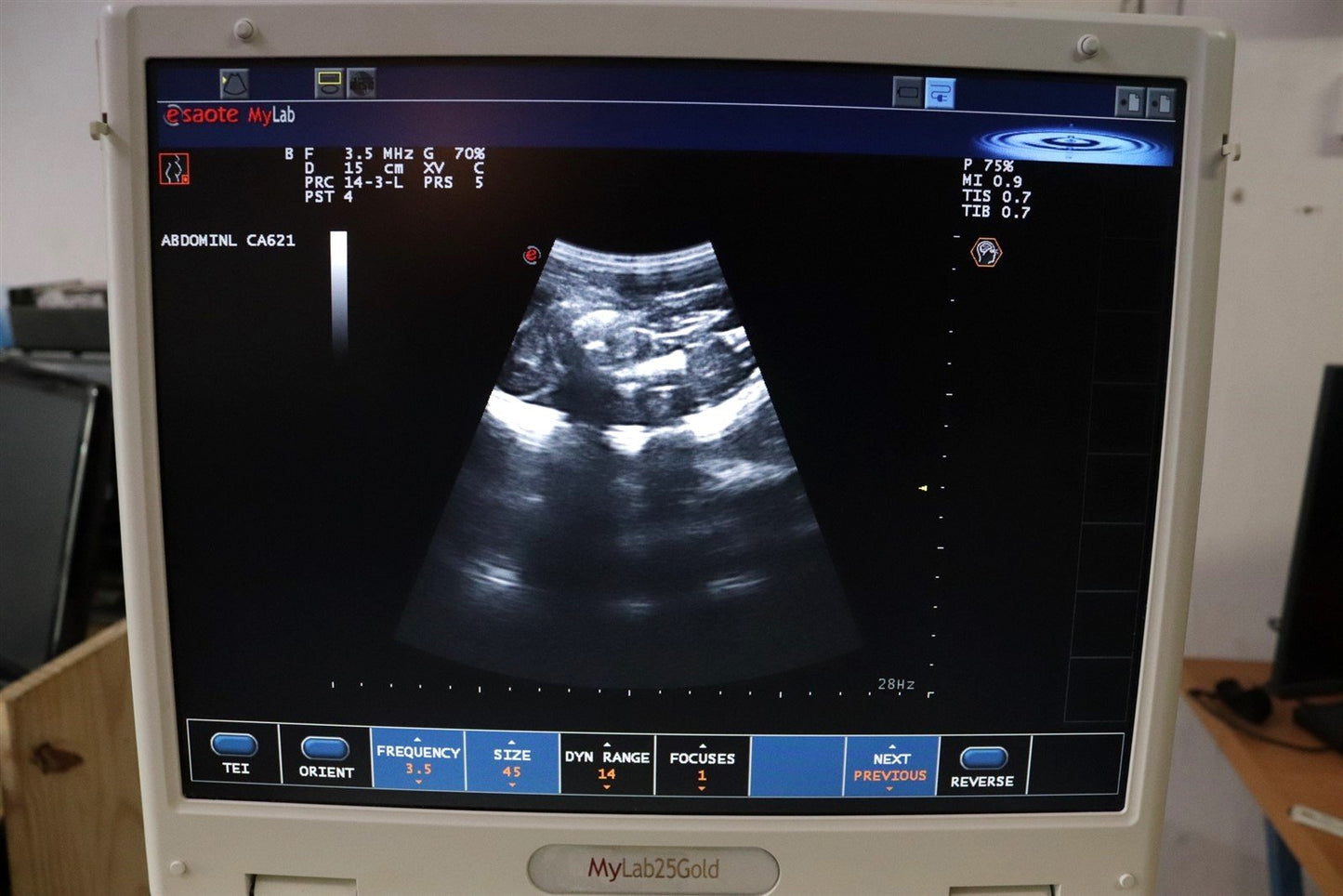 TESTED Esaote MyLab25 Gold 7340 Ultrasound With 2 Probes