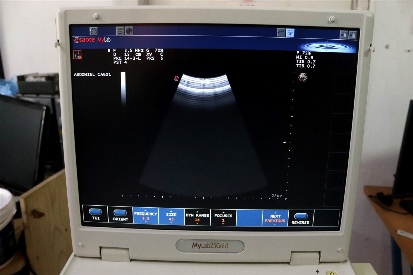 TESTED Esaote MyLab25 Gold 7340 Ultrasound With 2 Probes