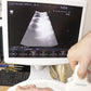 Hitachi Aloka Ultrasound F31 3 Probes Included