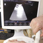 Hitachi Aloka Ultrasound F31 3 Probes Included